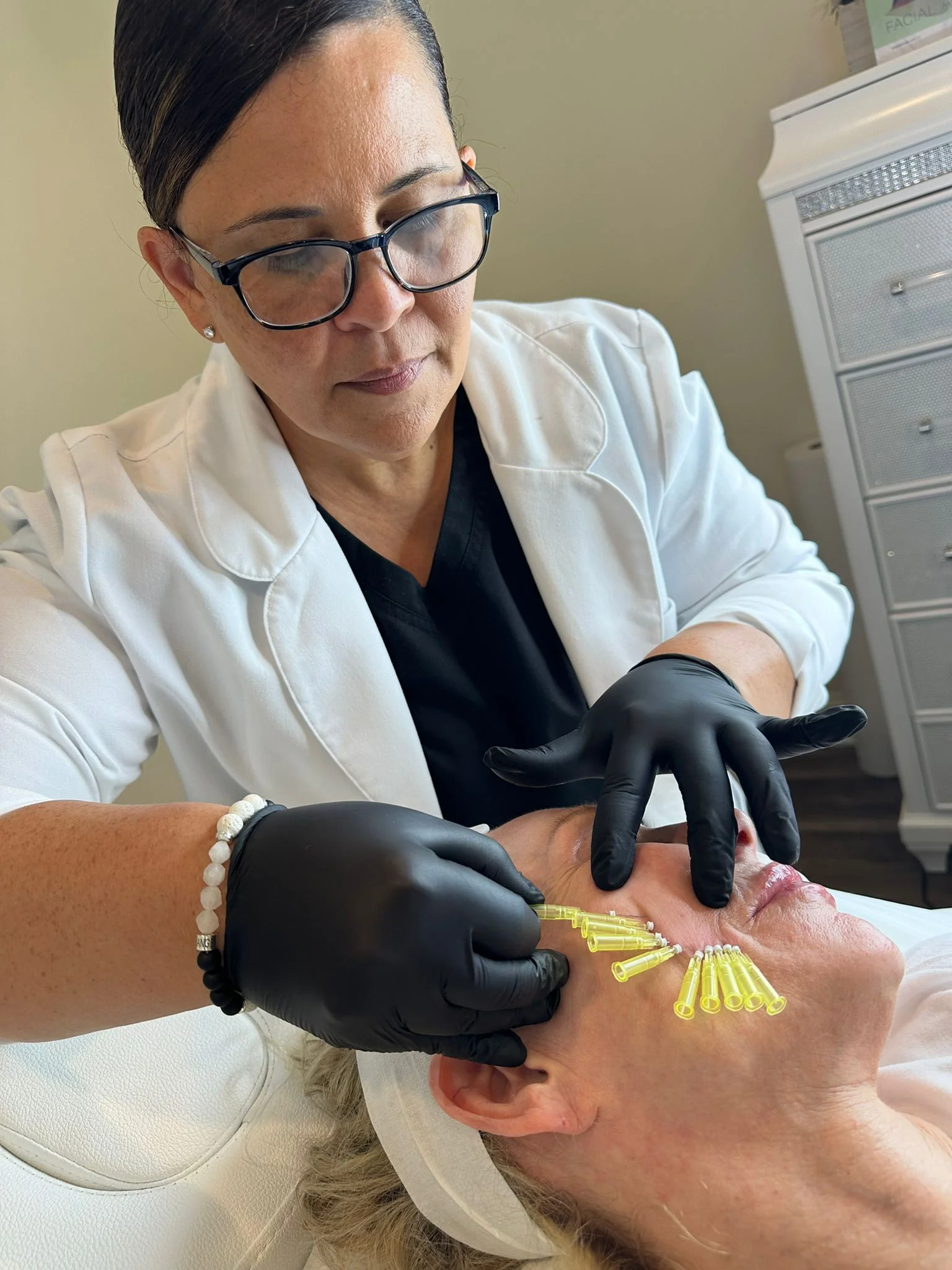 Smooth PDO Threads treatment